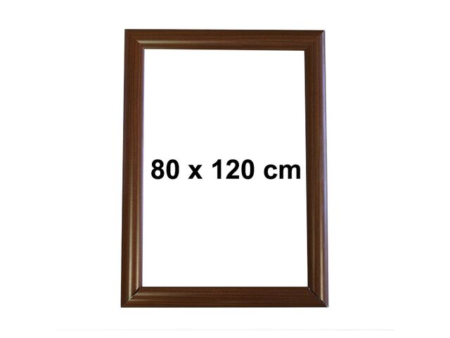 Tableau Sur Toile Palmier – 120x80 Cm – Impression Numérique – Visario – Prêt à Accrocher