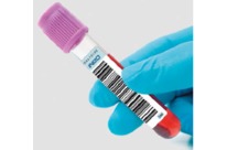 Etiquettes à fonctions congélation résistant à - 80° C