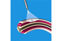 Laser pour microchirurgie  SETY