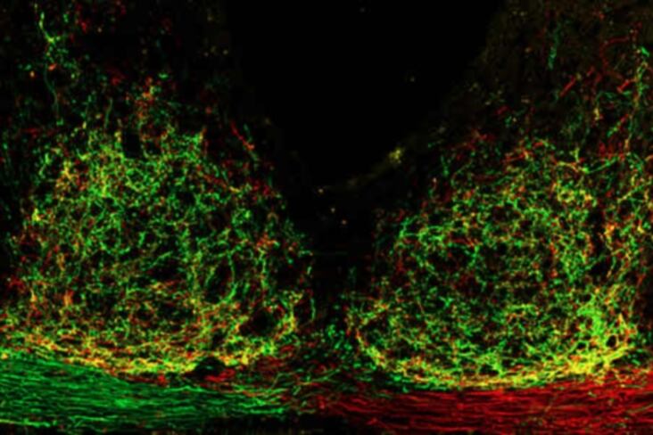 Biophotonics microscope Amazon