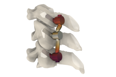 Concevoir des dispositifs médicaux grâce à la simulation multiphysique et l’intelligence artificielle