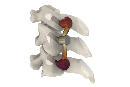 Concevoir des dispositifs médicaux grâce à la simulation multiphysique et l’intelligence artificielle
